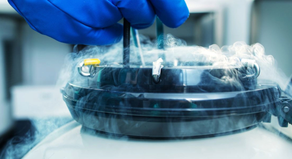 Cryogenic Handling